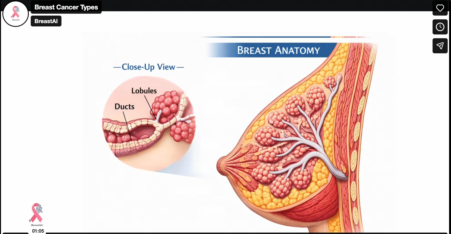 Breast Cancer Types